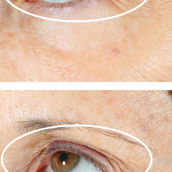 StriVectin Peptight 360° Tightening Eye Serum Set